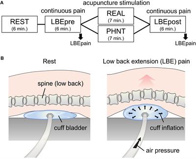 Differential Influence of Acupuncture Somatosensory and Cognitive/Affective Components on Functional Brain Connectivity and <mark class="highlighted">Pain Reduction</mark> During Low Back Pain State